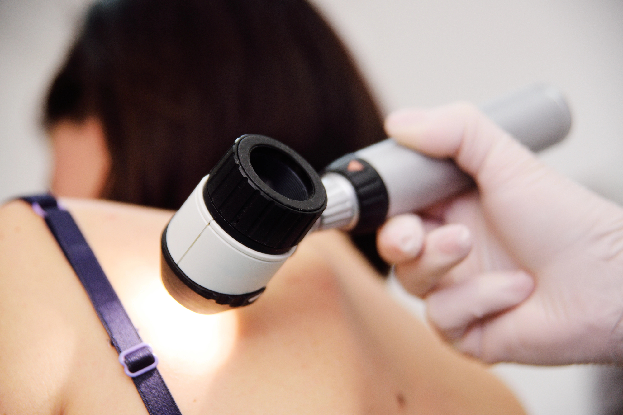 Dermatolog: zaveznik pri skrbi za zdravje.